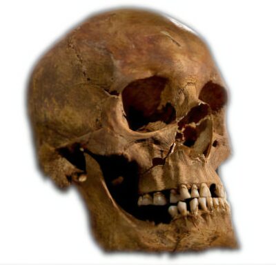 Skull of Richard III